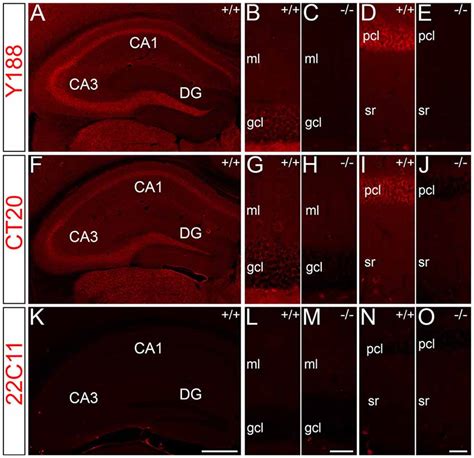 mouse amyloid protein